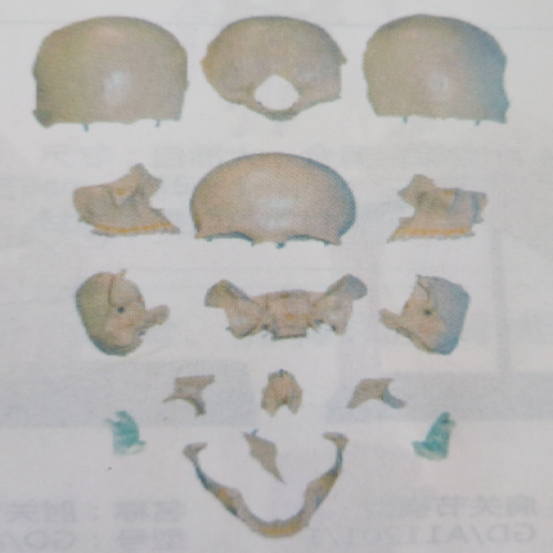 分离头颅骨散骨模型